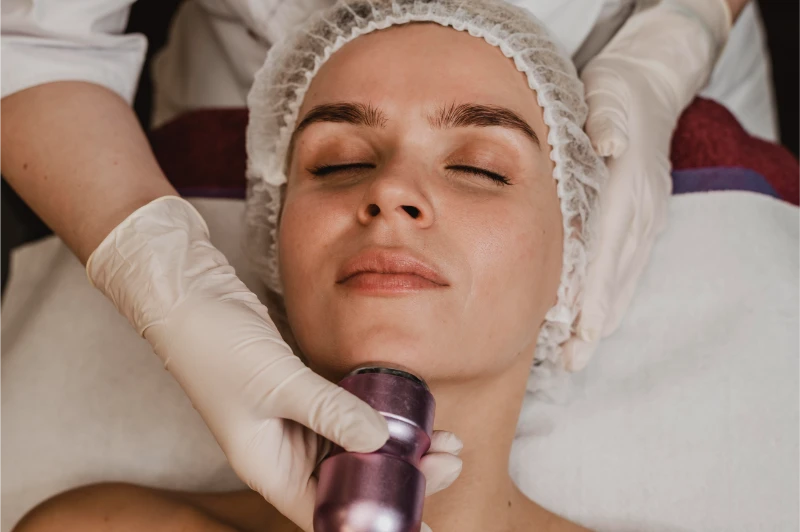 Woman receiving Morpheus8 radiofrequency microneedling treatment on jawline at Melbourne Skin clinic with practitioner using handheld device